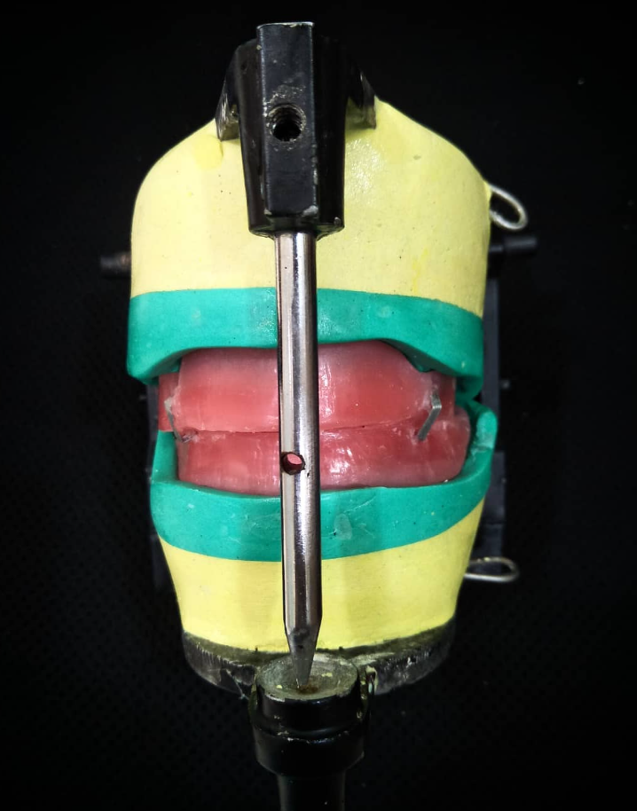 Precision Bite Analysis