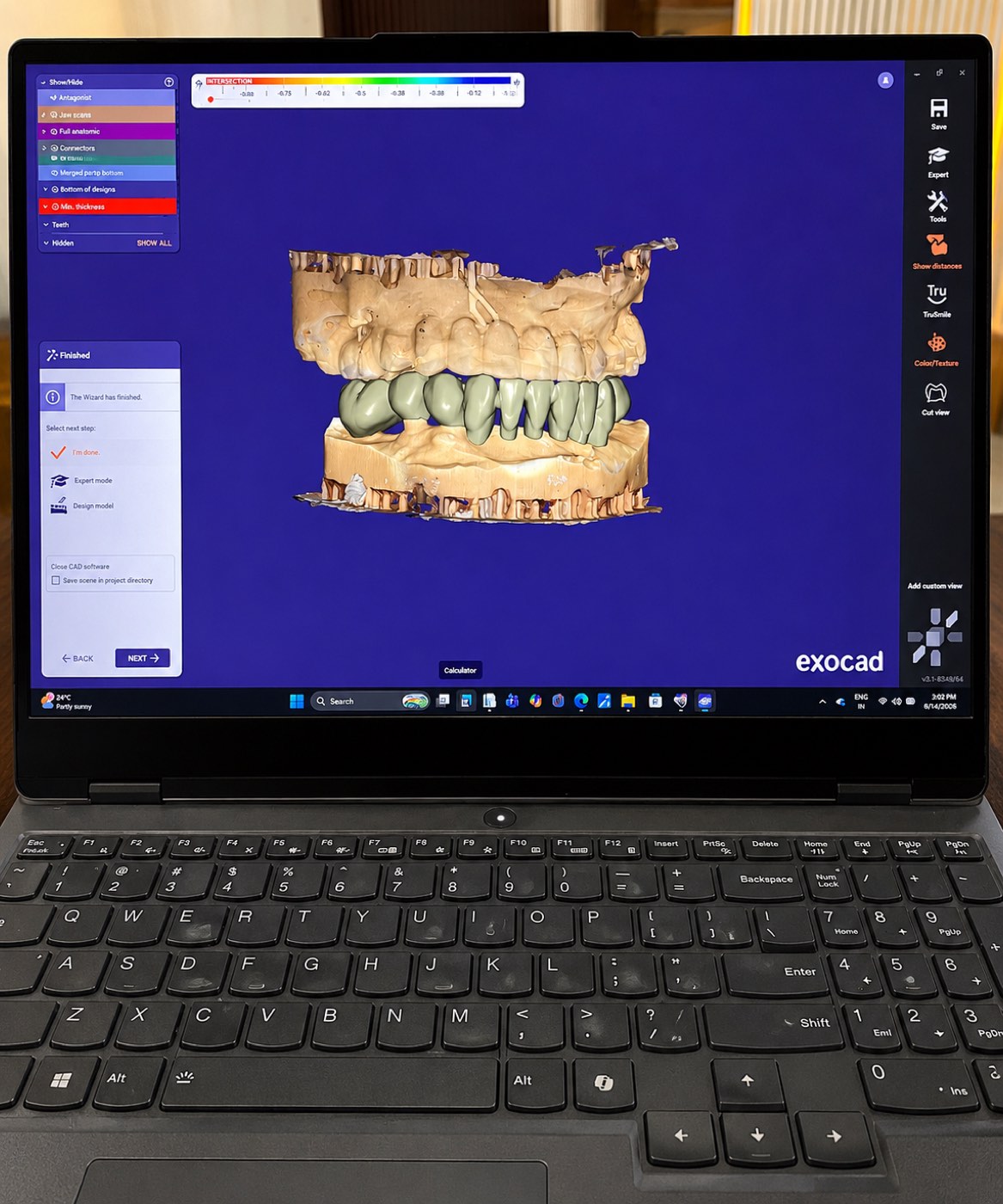 Digital Dental Design
